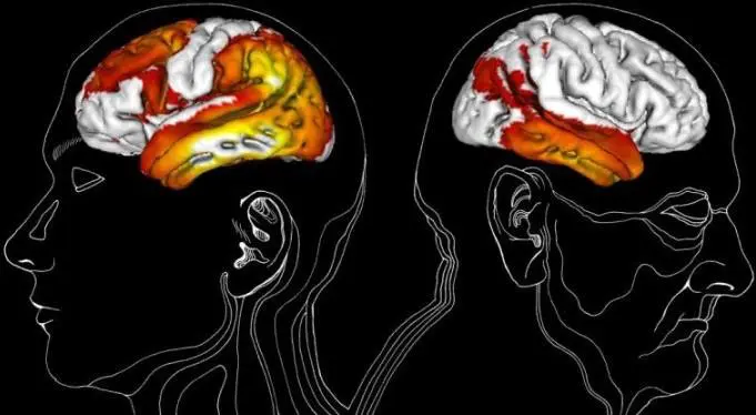 La sedentarietà colpisce il cervello, nelle aree della memoria