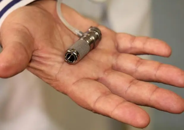 Un mini-cuore artificiale salva la vita ad una bambina di 3 anni