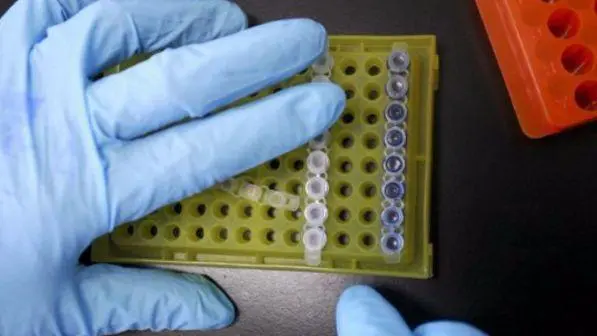 Dare la ‘sveglia’ al sistema immunitario per sconfiggere il tumore. Secondo uno studio italiano, è possibile