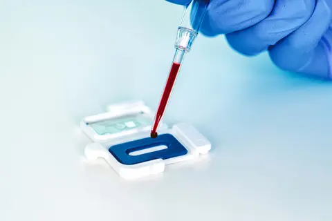 Il test ultrarapido predittivo per sepsi di Abionic, che consente la gestione della somministrazione di antibiotici, ottiene certificazione quale dispositivo medico-diagnostico in vitro