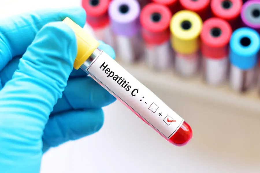 Screening gratuito per l’epatite C: più di 4500 test effettuati in Toscana
