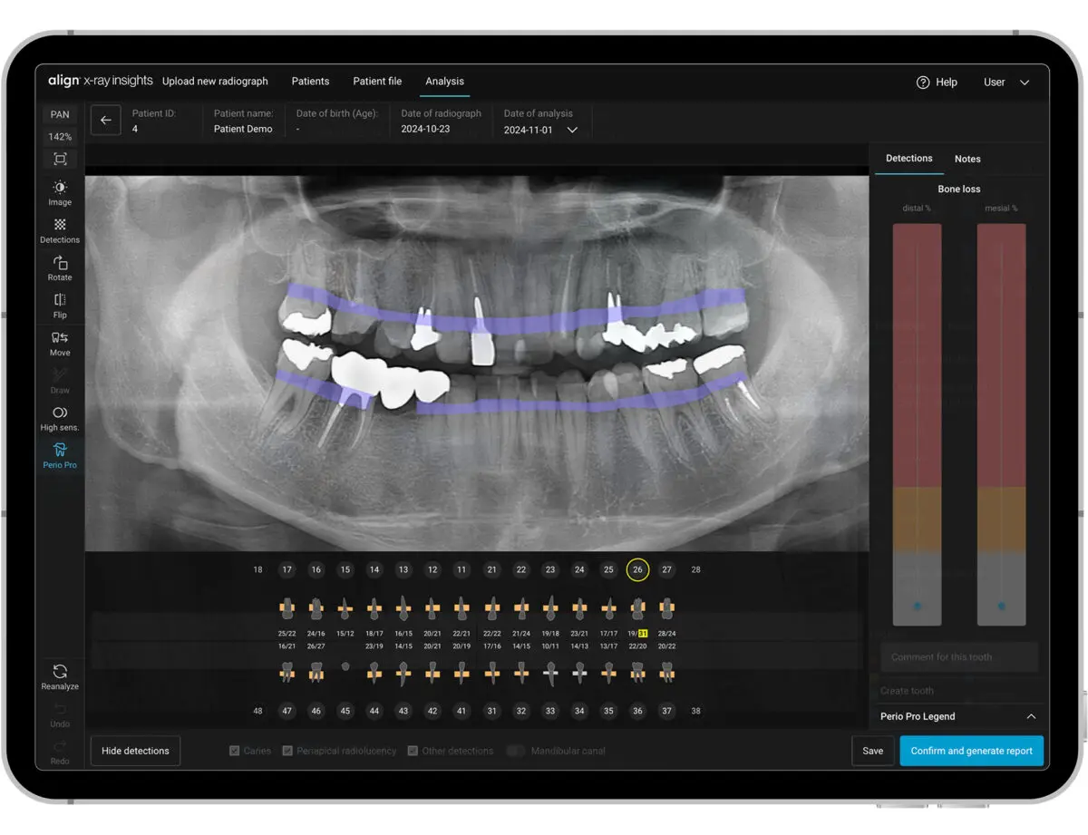 Rivoluzione digitale in odontoiatria: Align Technology lancia X-ray Insights con intelligenza artificiale